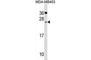 Image no. 1 for anti-Cell Death-Inducing DFFA-Like Effector C (CIDEC) (AA 97-126), (Center) antibody (ABIN2693635)