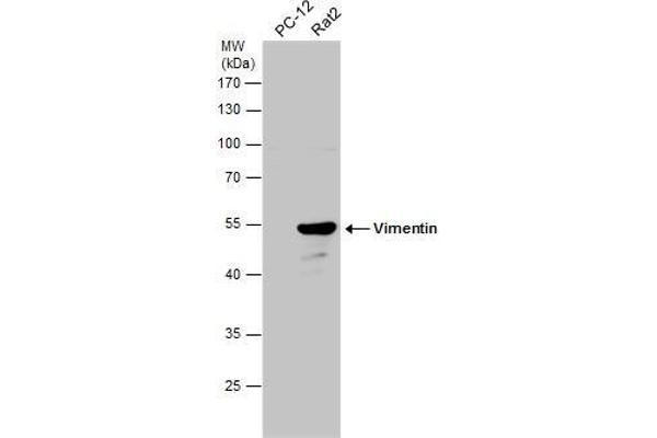 anti-Vimentin (VIM) (Center) antibody