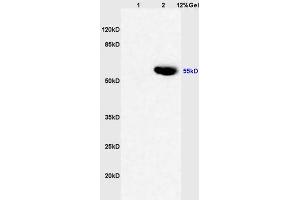 Image no. 3 for anti-Cytochrome P450, Family 3, Subfamily A, Polypeptide 4 (CYP3A4) (AA 18-120) antibody (ABIN733793)