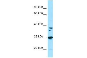 Image no. 1 for anti-Protein Phosphatase 1, Catalytic Subunit, beta Isoform (PPP1CB) (C-Term) antibody (ABIN2790274)