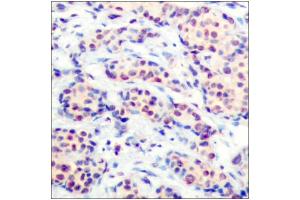 JunD antibody  (Ser255)