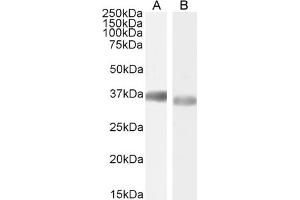 Image no. 22 for anti-Glyceraldehyde-3-Phosphate Dehydrogenase (GAPDH) (C-Term) antibody (ABIN185240)