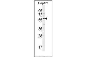 Image no. 2 for anti-Family with Sequence Similarity 20, Member C (FAM20C) (AA 443-471), (C-Term) antibody (ABIN951886)