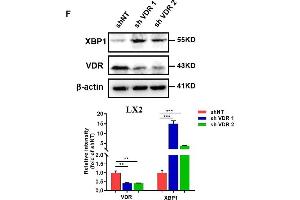 Image no. 1 for anti-Vitamin D Receptor (VDR) antibody (ABIN3023181)