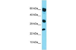 Image no. 1 for anti-Retinoic Acid Receptor Responder (Tazarotene Induced) 1 (RARRES1) (Middle Region) antibody (ABIN2788899)