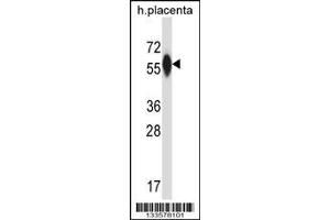 Image no. 1 for anti-Prolyl 4-Hydroxylase, alpha Polypeptide III (P4HA3) (AA 274-303) antibody (ABIN657608)