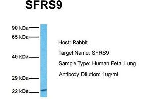 Image no. 4 for anti-serine/arginine-Rich Splicing Factor 9 (SFRS9) (Middle Region) antibody (ABIN2778869)