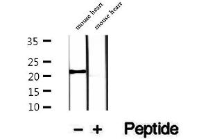 Image no. 2 for anti-Coenzyme Q Biosynthesis Protein 7 (Coq7) (Internal Region) antibody (ABIN6260974)