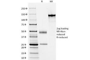 Image no. 2 for anti-Keratin Acidic (AE1) antibody (ABIN3024694)