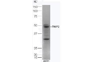Image no. 2 for anti-TNFAIP3 Interacting Protein 2 (TNIP2) (AA 85-180) antibody (ABIN872901)