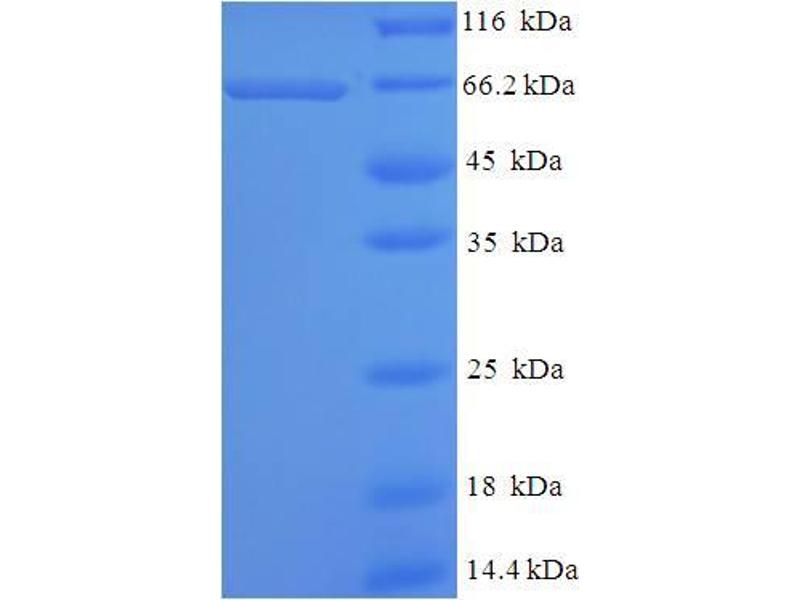 Human HNRNPH1 / hnRNP H Protein Recombinant His-SUMO aa 2-449