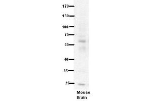 PDE9A antibody  (N-Term)