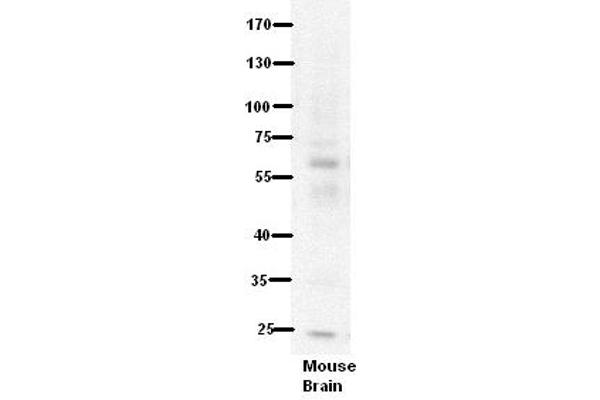 PDE9A antibody  (N-Term)