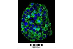 Image no. 2 for anti-Solute Carrier Family 11 (Proton-Coupled Divalent Metal Ion Transporters), Member 1 (SLC11A1) (AA 250-276) antibody (ABIN652453)