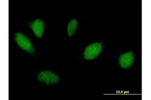 Image no. 2 for anti-Msh Homeobox 1 (MSX1) (AA 1-297) antibody (ABIN948151)