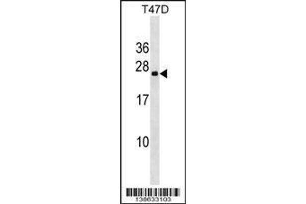anti-Variable Charge, X-Linked 3A (VCX3A) (AA 1-30), (N-Term) antibody