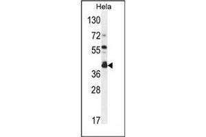 Image no. 1 for anti-Degenerative Spermatocyte Homolog 2, Lipid Desaturase (DEGS2) (AA 268-298), (C-Term) antibody (ABIN951878)