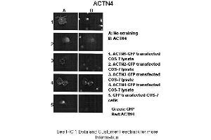 Image no. 4 for anti-Actinin, alpha 4 (ACTN4) (N-Term) antibody (ABIN2775288)