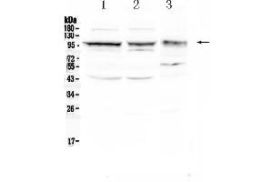 Image no. 1 for anti-Activated Leukocyte Cell Adhesion Molecule (ALCAM) (AA 167-406) antibody (ABIN5518801)