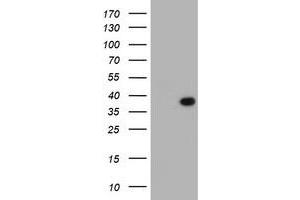 Image no. 1 for anti-Leucine Rich Repeat Containing 39 (LRRC39) antibody (ABIN2724913)