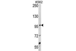 Image no. 2 for anti-Unc-5 Homolog C (C. Elegans) (Unc5c) (Middle Region) antibody (ABIN453453)