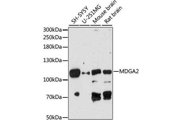 MDGA2 antibody