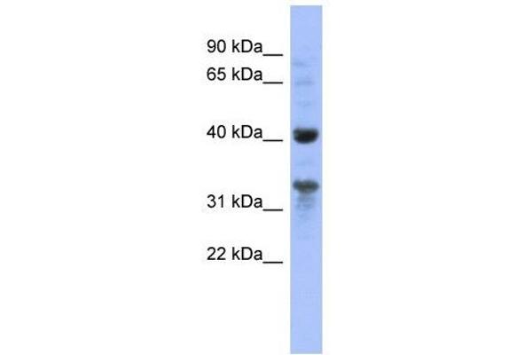 anti-Mitochondrial Ribosomal Protein L37 (MRPL37) (N-Term) antibody