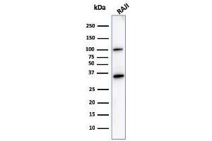 Image no. 1 for anti-Membrane-Spanning 4-Domains, Subfamily A, Member 1 (MS4A1) antibody (ABIN6941107)