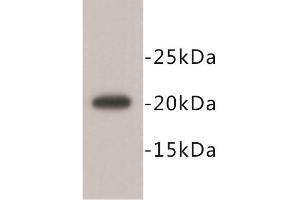 Image no. 1 for anti-Geminin, DNA Replication Inhibitor (GMNN) antibody (ABIN1843722)