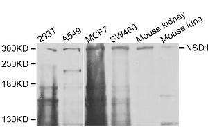 Image no. 1 for anti-Nuclear Receptor Binding SET Domain Protein 1 (NSD1) antibody (ABIN6572111)