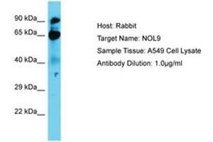 Image no. 1 for anti-Nucleolar Protein 9 (NOL9) (AA 74-123) antibody (ABIN6750676)