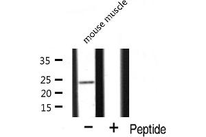 Image no. 4 for anti-Mitochondrial Ribosomal Protein L13 (MRPL13) (C-Term) antibody (ABIN6258512)