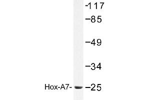 Image no. 1 for anti-Homeobox A7 (HOXA7) antibody (ABIN272304)