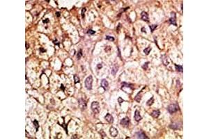 Image no. 4 for anti-Angiotensin I Converting Enzyme 2 (ACE2) (AA 59-90) antibody (ABIN3029962)