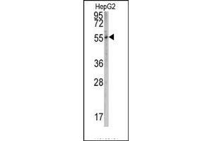 Image no. 1 for anti-Cytochrome P450, Family 2, Subfamily W, Polypeptide 1 (CYP2W1) (N-Term) antibody (ABIN360102)