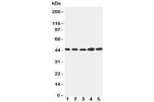Image no. 1 for anti-Hepsin (HPN) (C-Term) antibody (ABIN3031191)