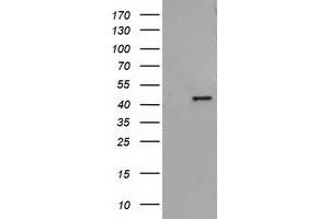 Image no. 1 for anti-Alcohol Dehydrogenase 1B (Class I), beta Polypeptide (ADH1B) antibody (ABIN1496477)