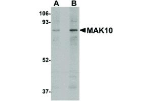 anti-MAK10 Homolog, Amino-Acid N-Acetyltransferase Subunit (MAK10) (Internal Region) antibody