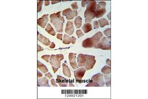Image no. 2 for anti-Protein Associated with Topoisomerase II Homolog 1 (PATL1) (AA 489-518), (C-Term) antibody (ABIN653753)