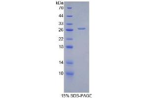Image no. 1 for Alanine Aminotransferase (ALT) (AA 255-492) protein (His tag) (ABIN1877166)