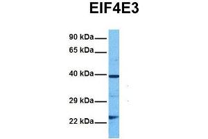Image no. 2 for anti-Eukaryotic Translation Initiation Factor 4E Family Member 3 (EIF4E3) (Middle Region) antibody (ABIN2776663)