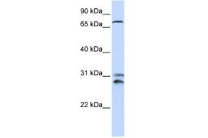 Image no. 1 for anti-Tousled-Like Kinase 2 (TLK2) (N-Term) antibody (ABIN2787644)