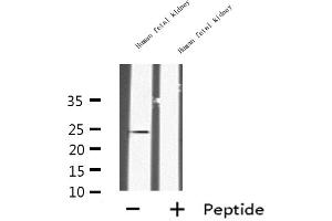 INSL6 antibody  (Internal Region)