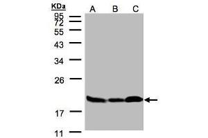 Image no. 4 for anti-Stathmin 1 (STMN1) (C-Term) antibody (ABIN2855912)