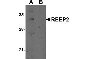 Western Blotting (WB) image for anti-Receptor Accessory Protein 2 (REEP2) (Middle Region) antibody (ABIN1031057)