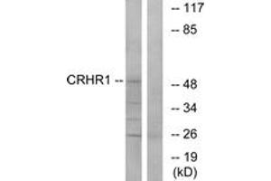 Image no. 2 for anti-Corticotropin Releasing Hormone Receptor 1 (CRHR1) (AA 75-124) antibody (ABIN1535580)