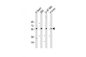 Image no. 6 for anti-Ectonucleoside Triphosphate diphosphohydrolase 2 (ENTPD2) (AA 86-113), (N-Term) antibody (ABIN653273)