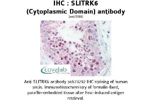Image no. 1 for anti-SLIT and NTRK-Like Family, Member 6 (SLITRK6) (Cytoplasmic Domain) antibody (ABIN1739440)