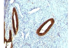 Image no. 5 for anti-Keratin 19 (KRT19) antibody (PE) (ABIN6172204)