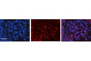 Image no. 6 for anti-Fibroblast Growth Factor 2 (Basic) (FGF2) (Middle Region) antibody (ABIN2777106)